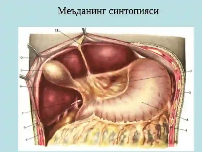 Меъдага ва 12 бармоқли ичак скелетотопияси 3
