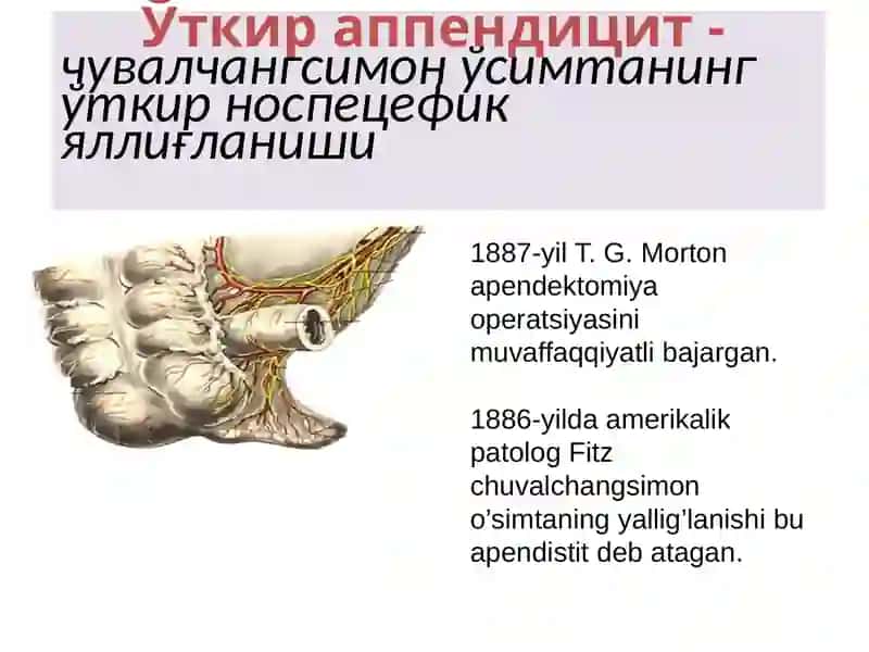 3 yoshgacha bo’lgan bolalarda O`tkir appenditsit 3