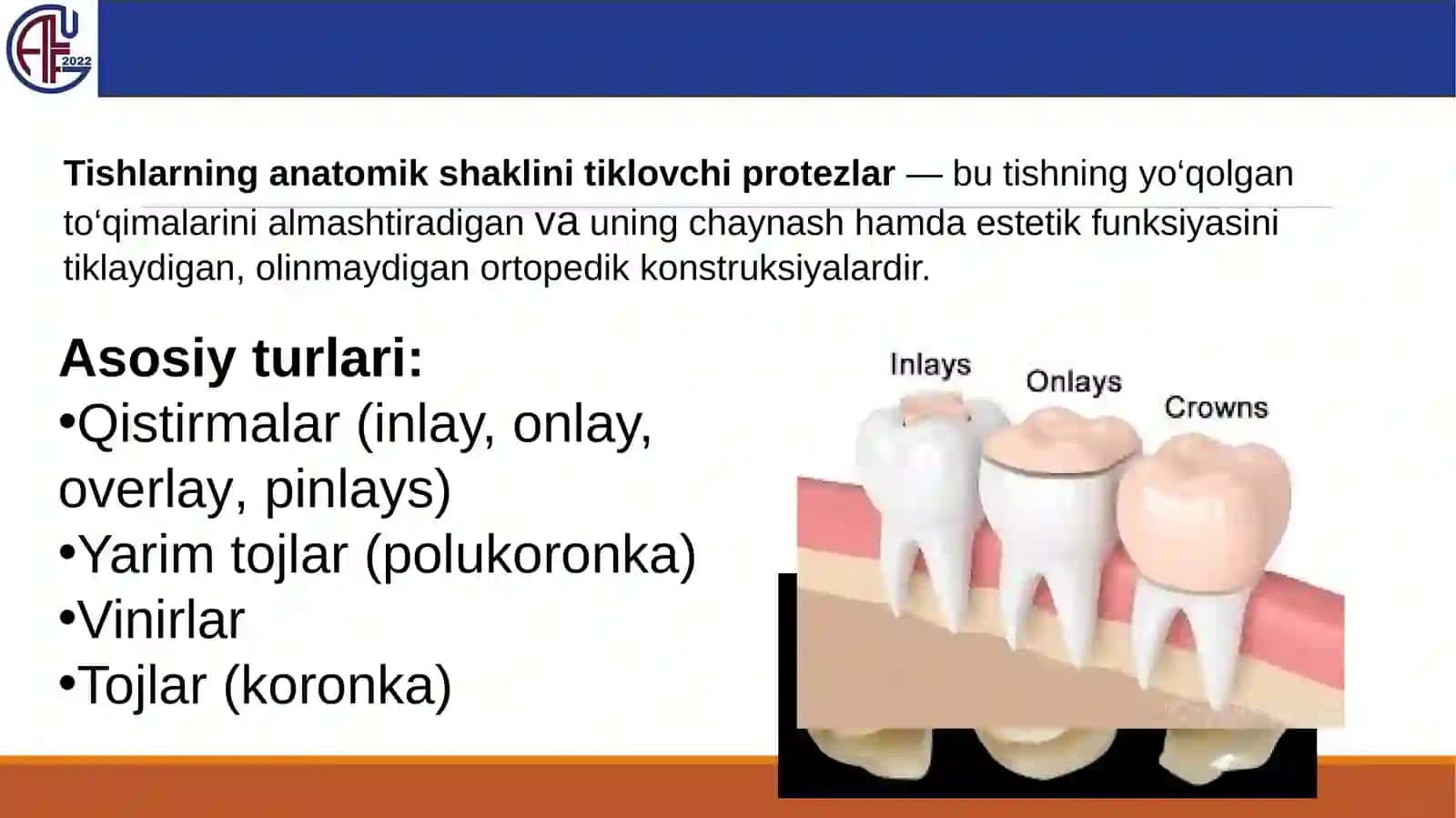 Tishlarning anatomik shaklini tiklaydigan protez turlari 3