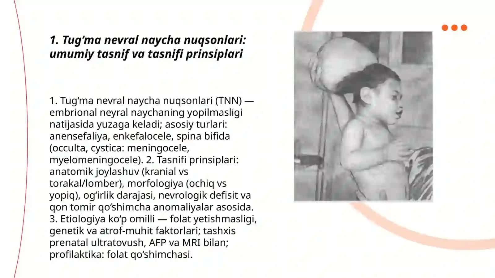 Bosh miya va orqa miya tug‘ma rivojlanish nuqsonlari 3