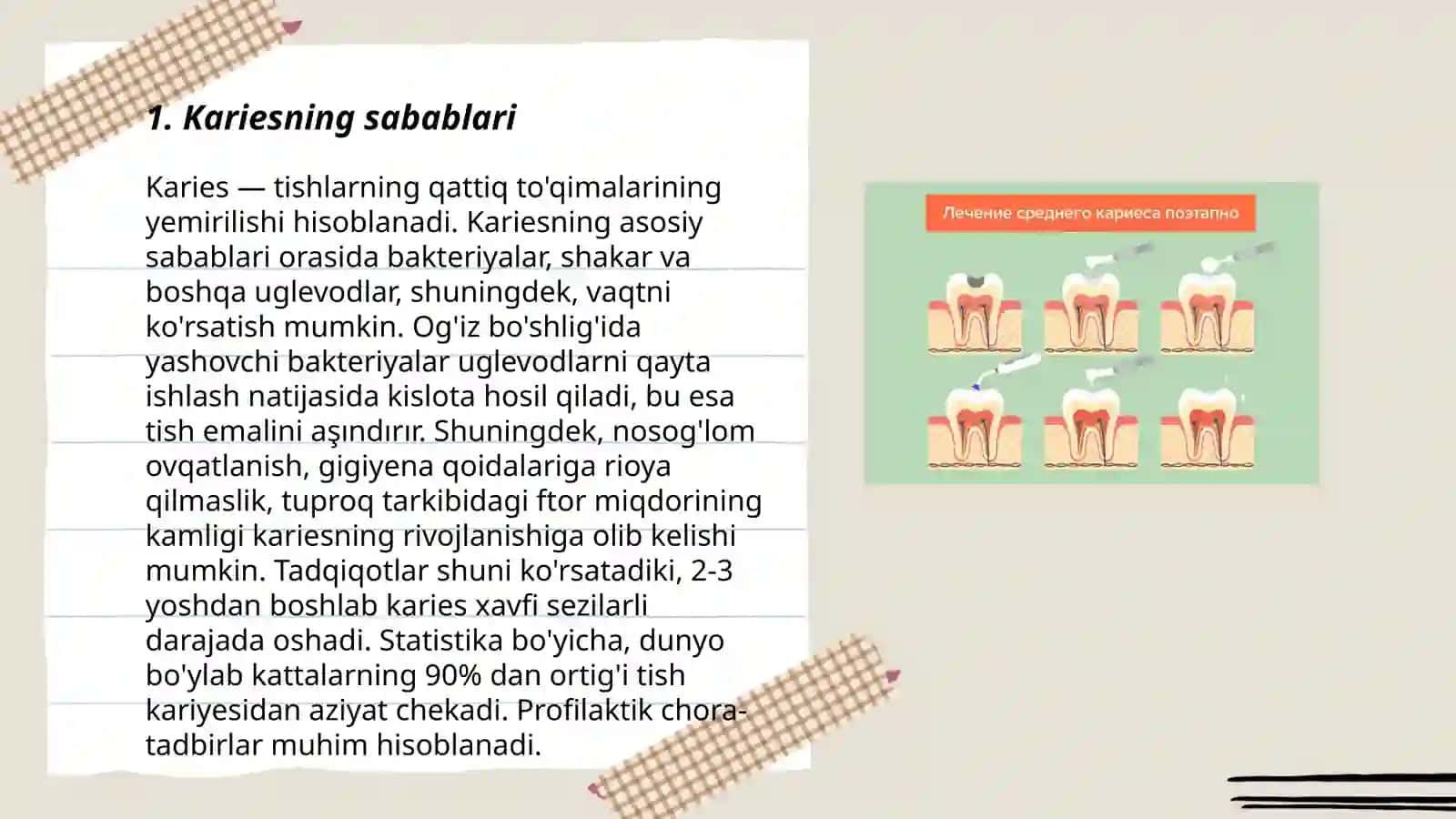 Karies 3