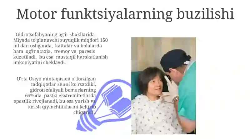 Gidrotsefaliyaning kelib chiqish sabablari va asoratlari 3