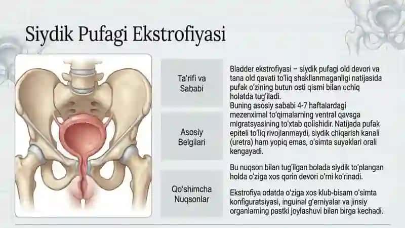 Kichik chanoq a'zolari tug'ma nuqsonlari ekstrofiya, siyodik pufaki divertikuli, to'g'ri ichak 3