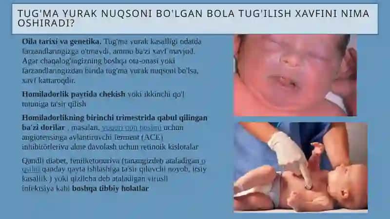 Tug’mayurak nuqsonlari 3