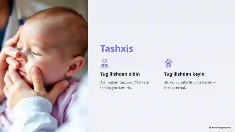 DaunSindromi 3