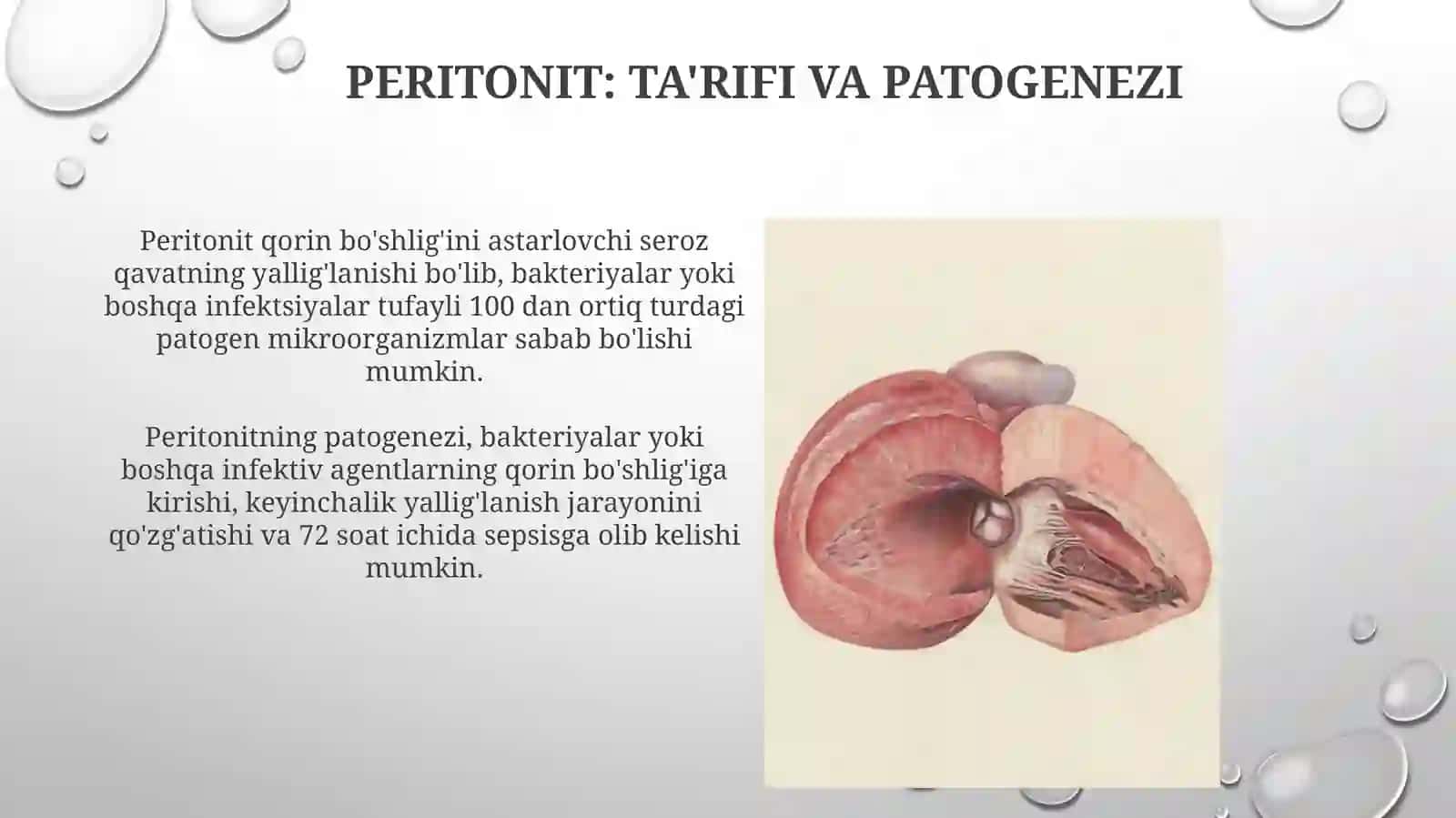Peritonitning klinik ko'rinishi va davolash usullari 3
