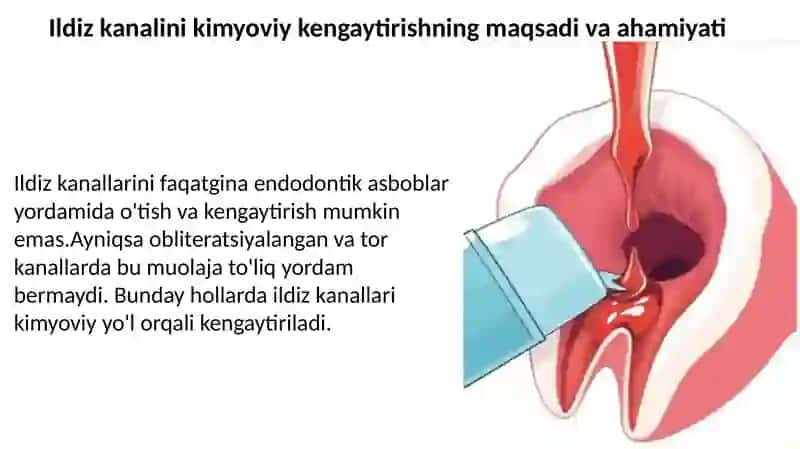 Ildiz kanallarini kimyoviy kengaytirish 3
