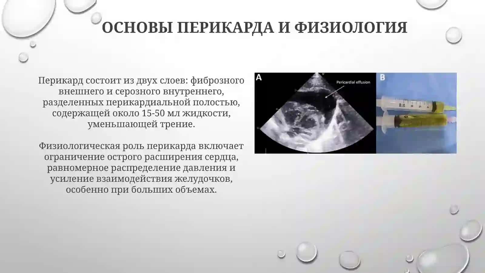 Нарушения функции сердца при патологии перикарда 3