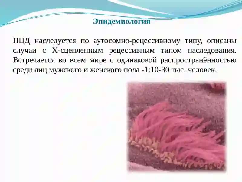Синдром Картагенера 3