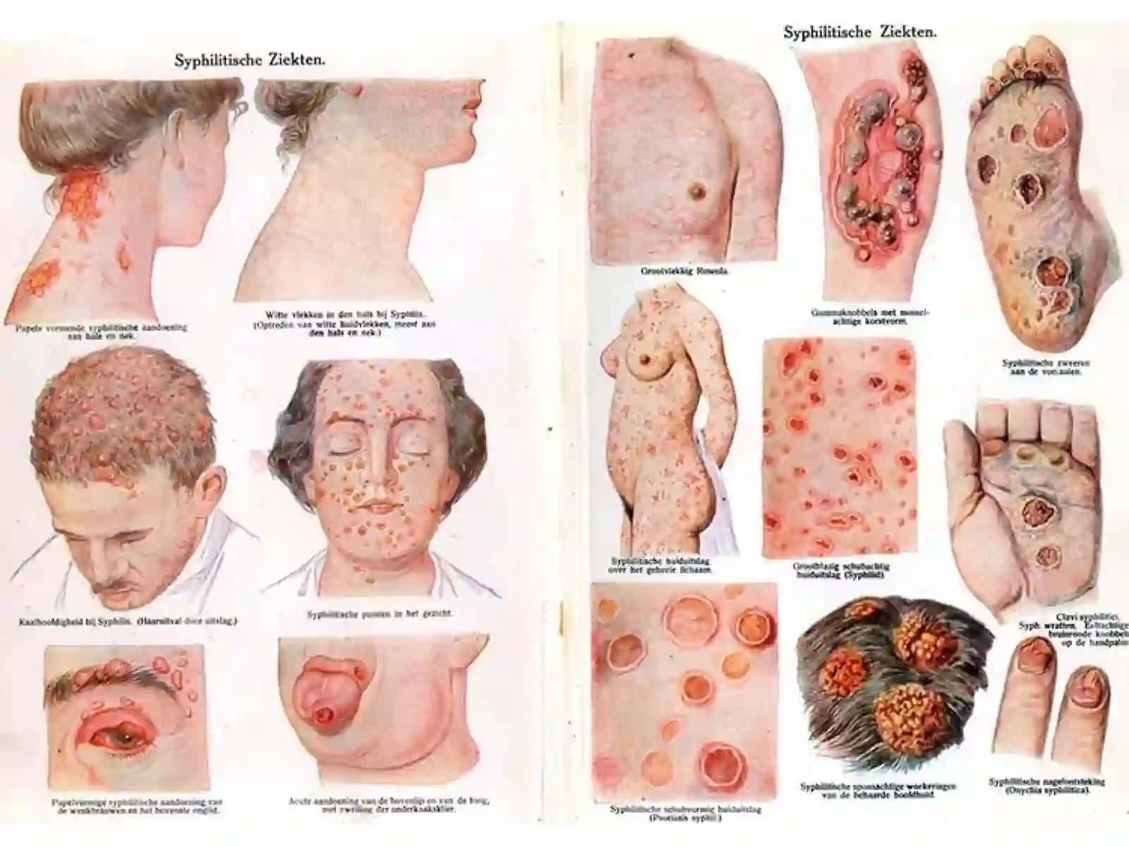 Zaxm diagnostikasi 3