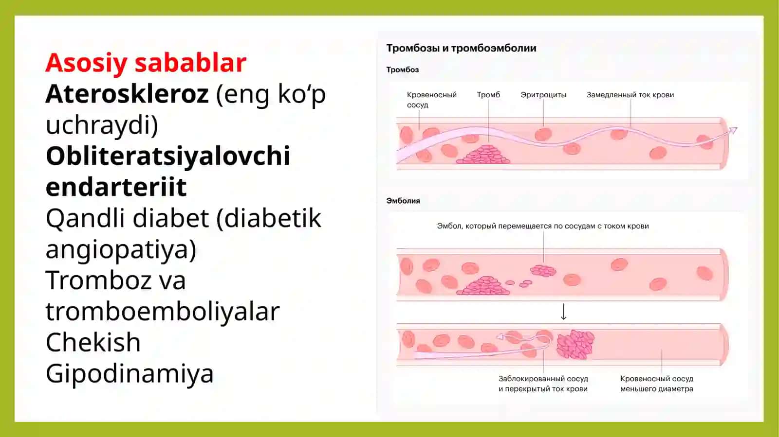 Arterial qontomirlar nisurunkali obliteratsiyasi davriy va olam hozirdagi volash usullari 3