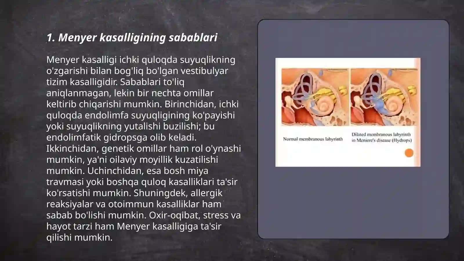 Menyer kasalligi va zamonaviy davolash usullari 3