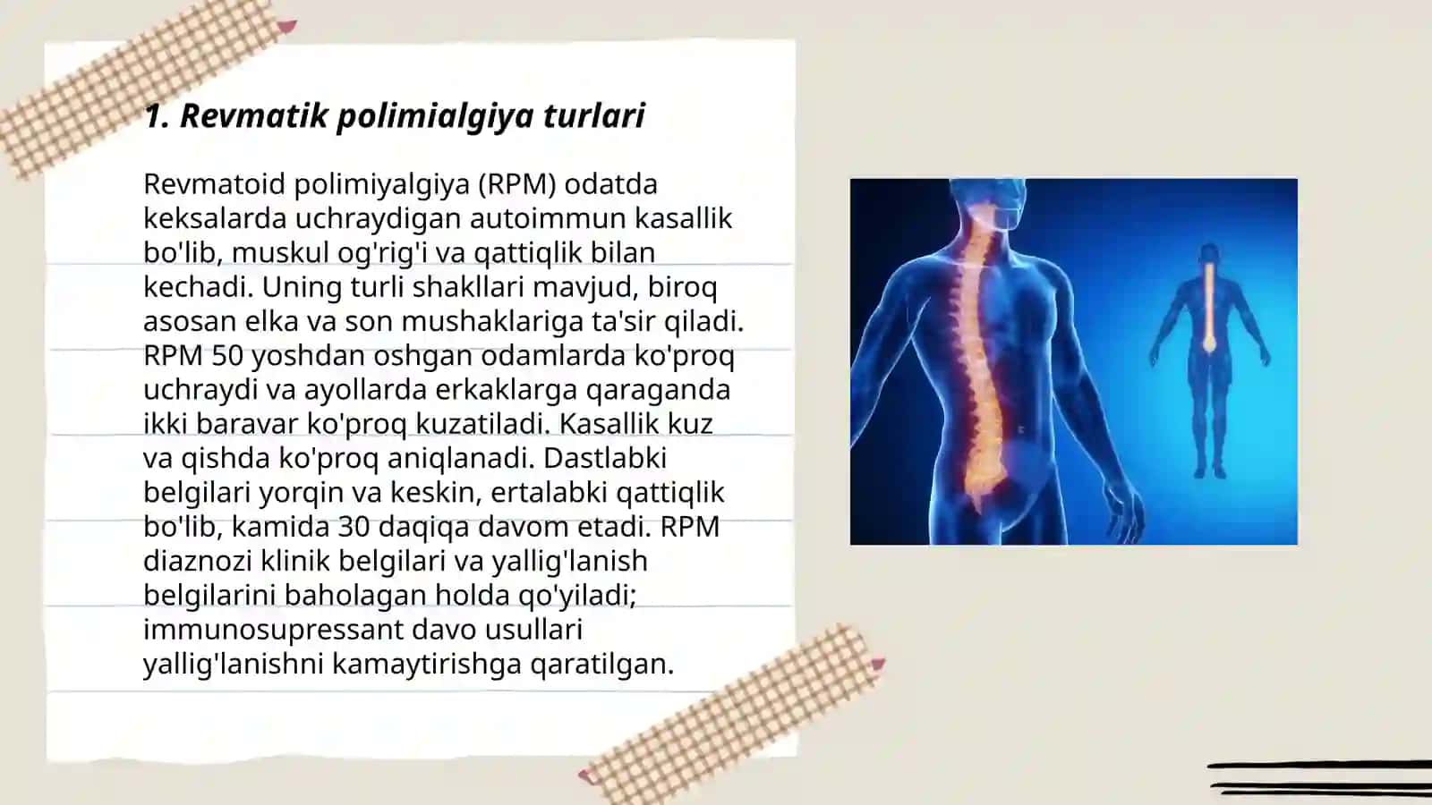Revmatik polimialgiya 3
