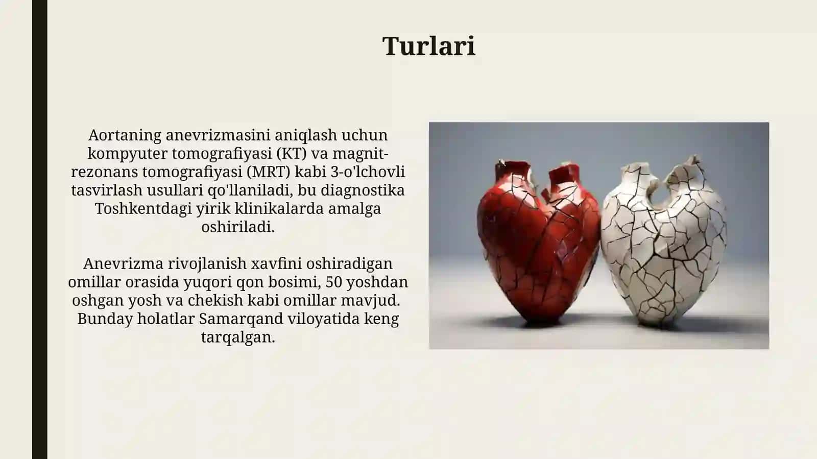 Aortaanevrizmasi 3