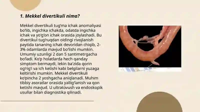 Mekkel divertikulini olish operatsiyasi 3