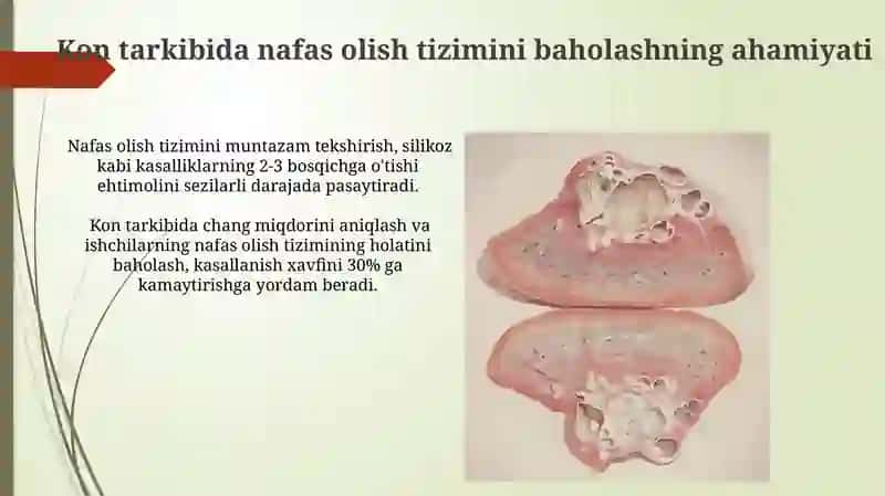 Konchlarda nafas olish tizimini baholash 3