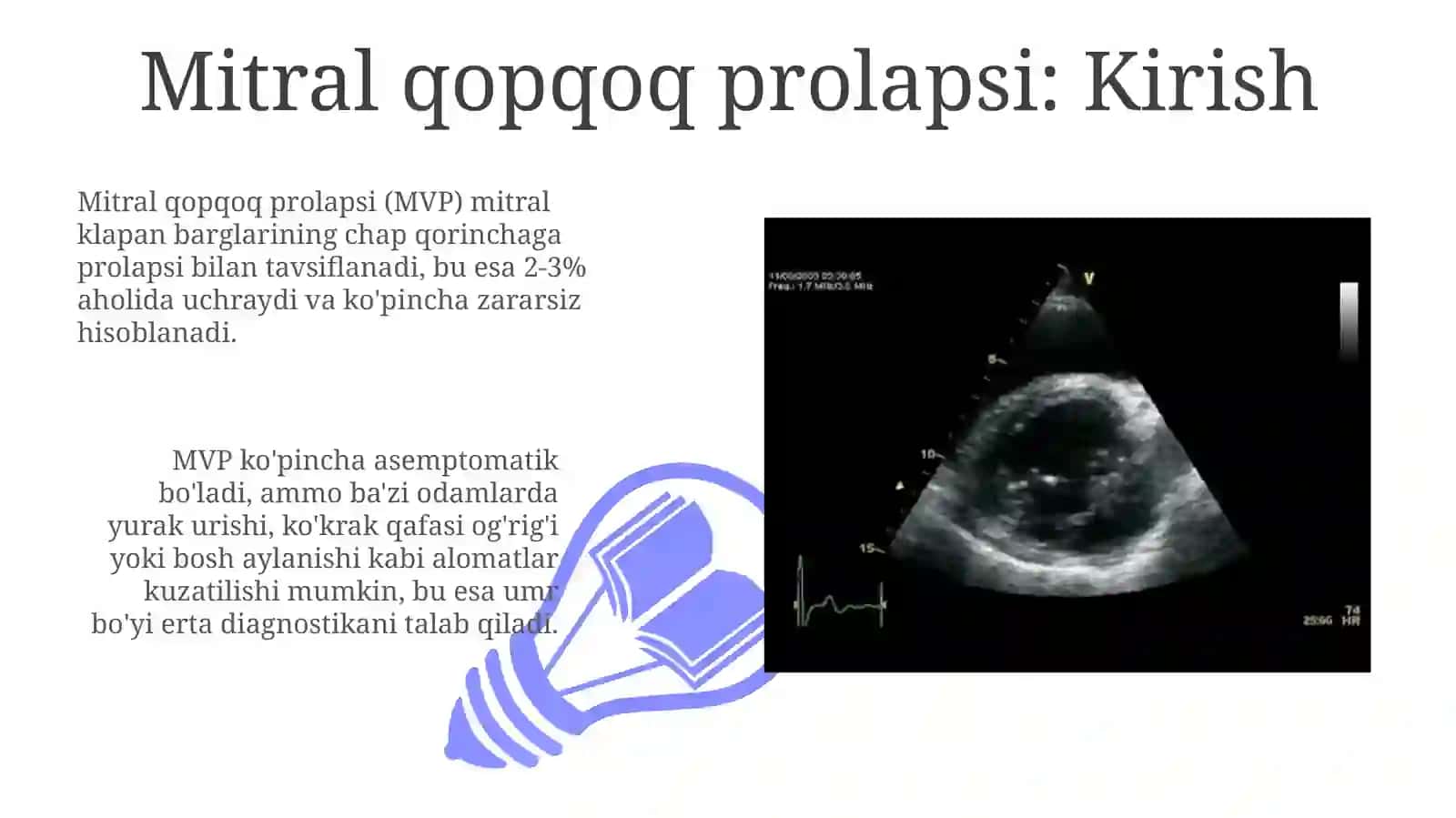 Mitral klapan prolapse 3