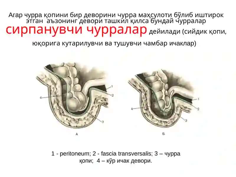 Қоринчурралари 3