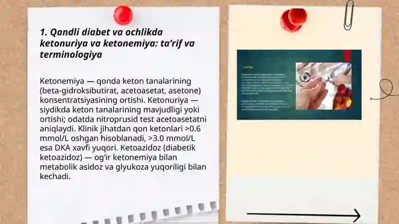 Qandli diabet va ochlikda ketonuriya va ketonemiya 3