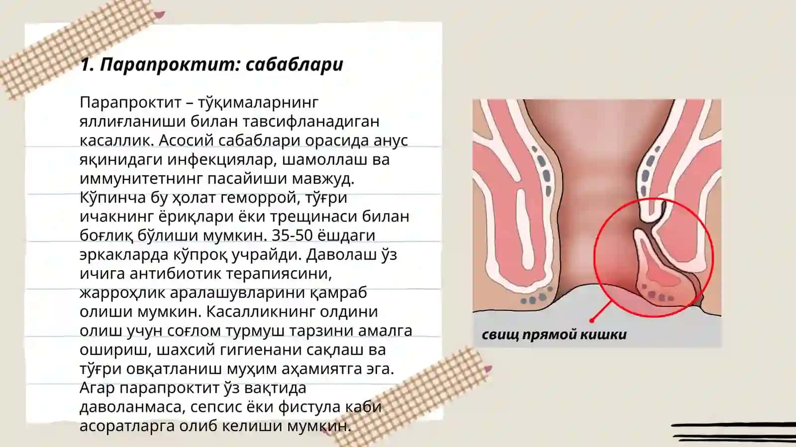 Парапроктит 3