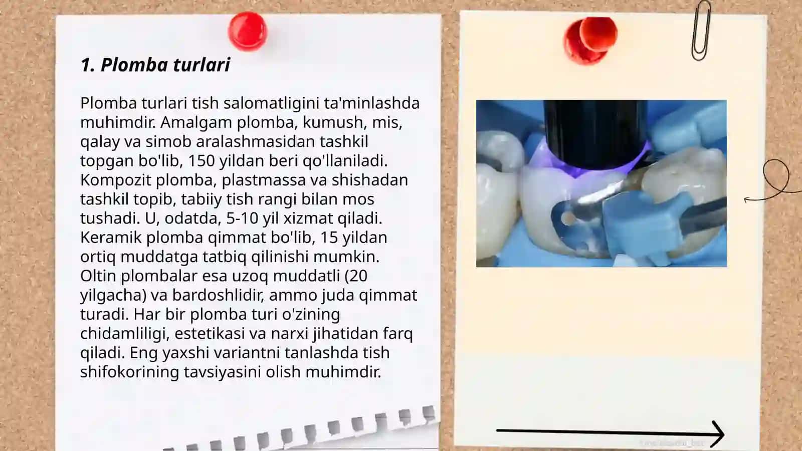 Plomba va uning turlari Plomba ashyolari va ularning tasnifi 3