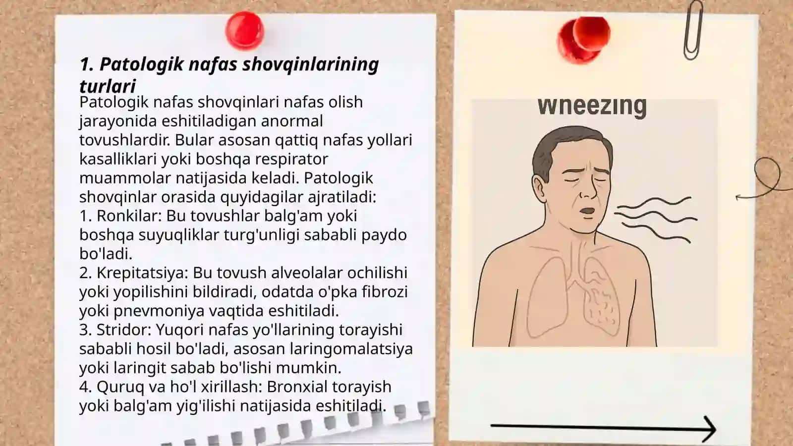 Patologik nafas shovqinlari. Xirillashlar. Ularning tavsifi, kelib chiqishi va sabablari 3