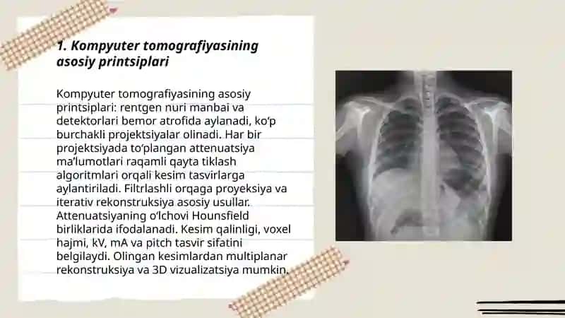 Kompyuter tomografiyasi 3