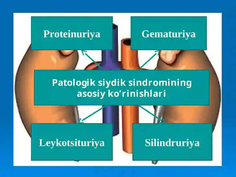 Siydik chiqaarish yo’llari neyrogen disfunksiyasi 3