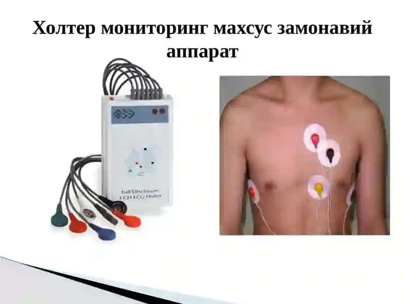 Юрак касалликларини замонавий текшириш усуллари 3