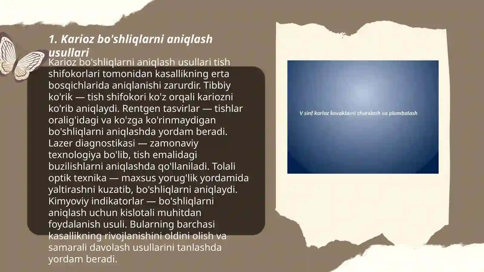 Karioz bo'shliqlarni aniqlash usullari 3