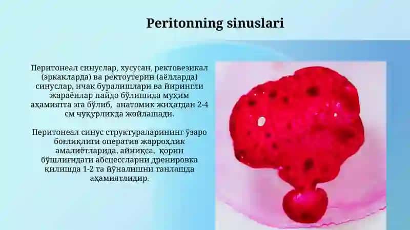 Peritoneal Sinuslar 3
