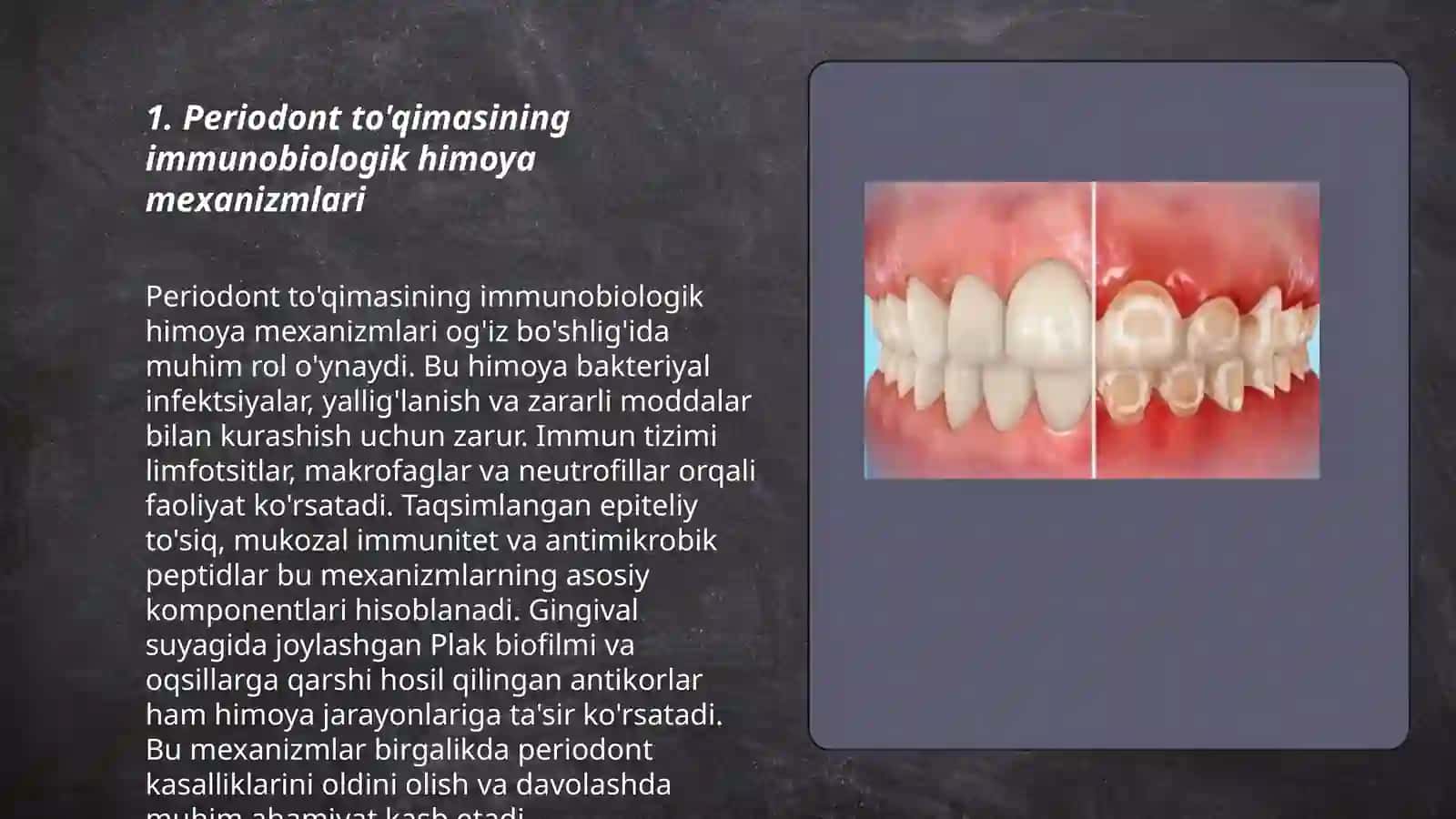 Periodont to’qimasining immunobiologik himoya vazifasi 3