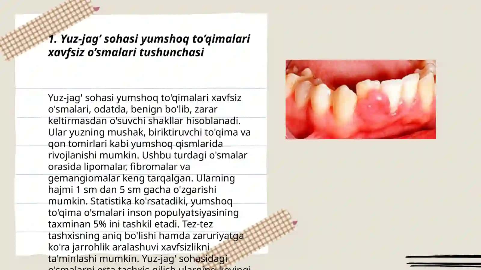 Yuz-jag’ sohasi yumshoq to’qimalari xavfsiz o’smalari va o’smasimon hosilalari 3