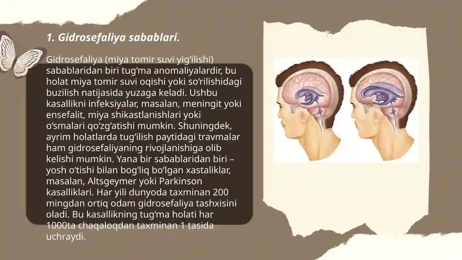 Gidrosefaliyaning kelib chiqish sabablari va asoratlari 3