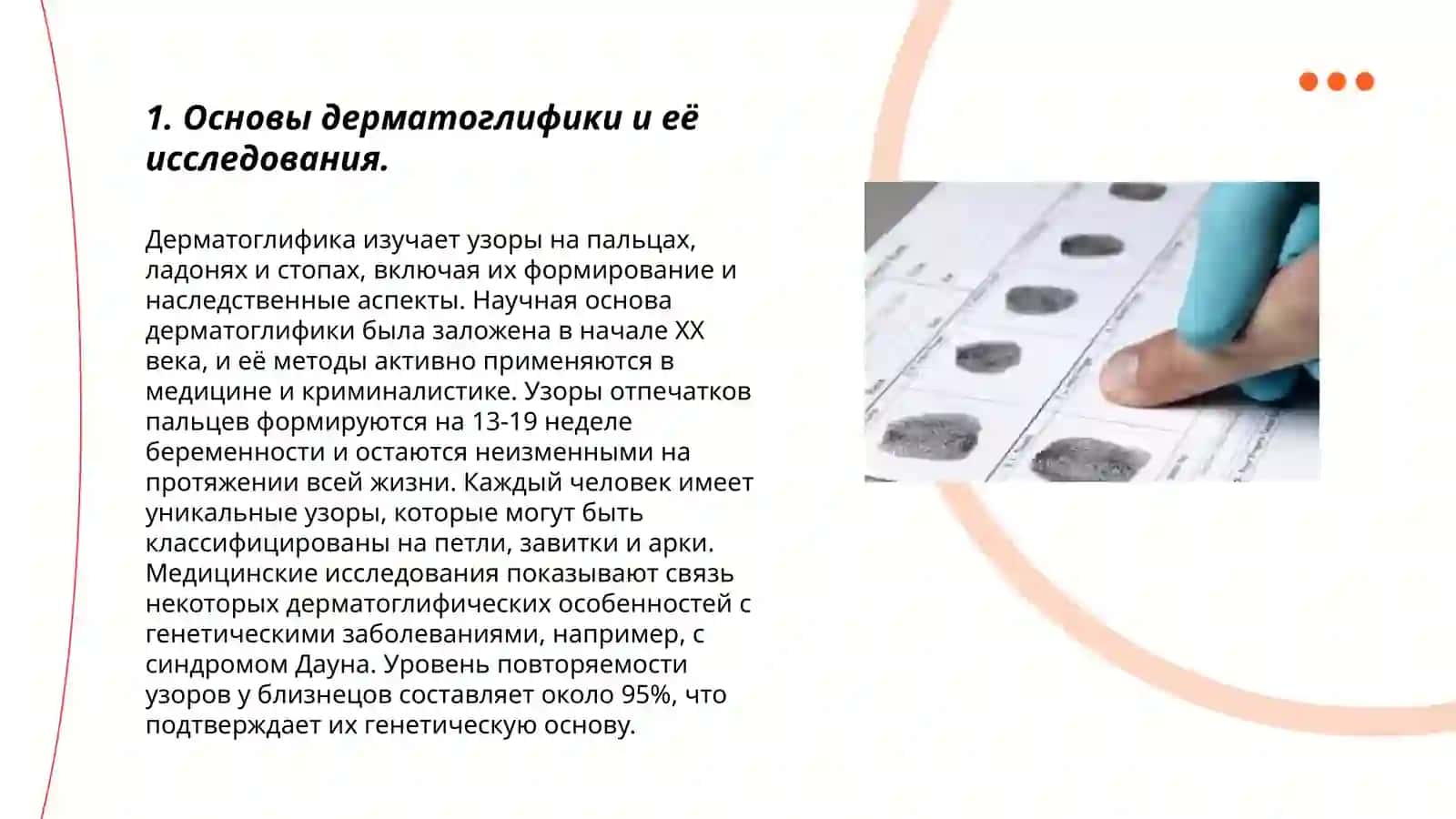 Дерматоглифика. Дактилоскопия. Дерматоглифические показатели (изменения) при различных наследственных болезней 3
