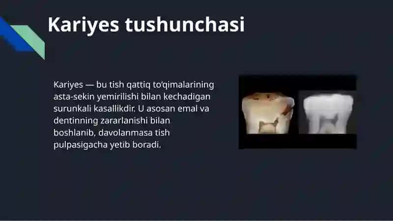 Kariyes haqida tushuncha 3