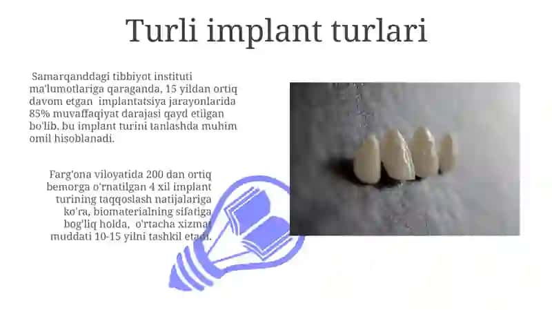 Tish implantlari 3