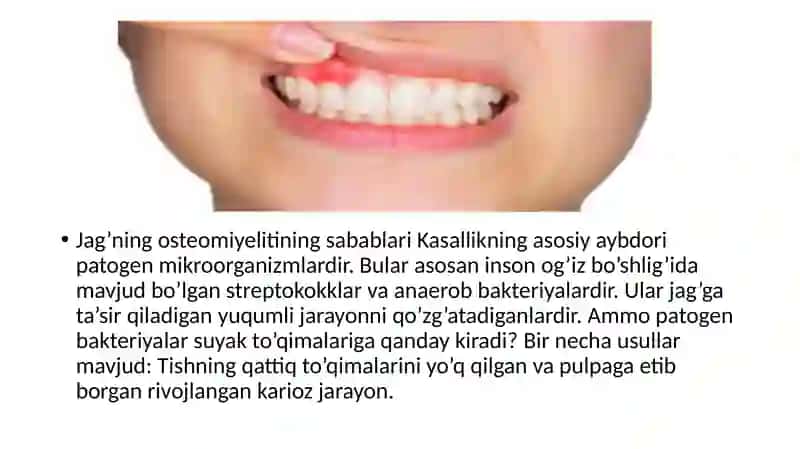 YuqorijağÕtkirosteomiyelitiVaAtrofdagiRivojlanganapsessVaFlegmonalari(Periostit,TanglayAbsessikozKosasi,lunj,Chakkaosti,YanoqSoxalariflegmonalariНормухамбетовКамрон411-C 3