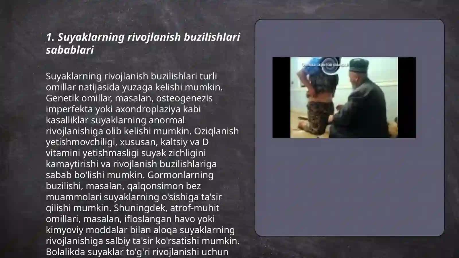Suyaklarni rivojlanish buzilishlari.Sinishlar.Osteonekroz 3