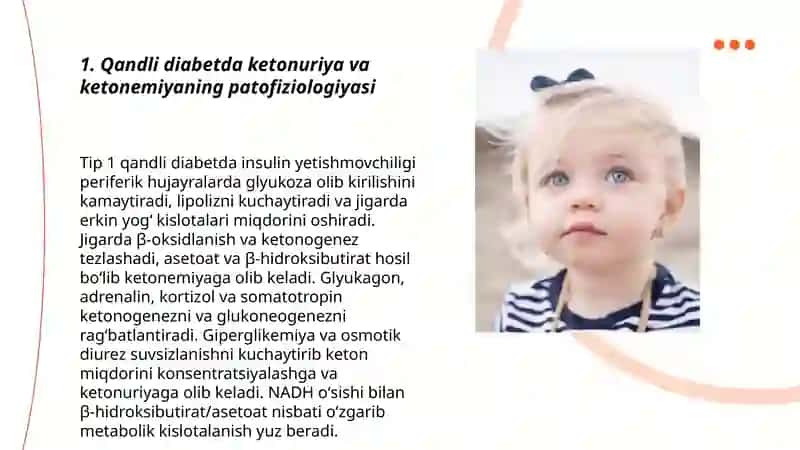 Qandli diabet va ochlikda ketonuriya va ketonemiya 3