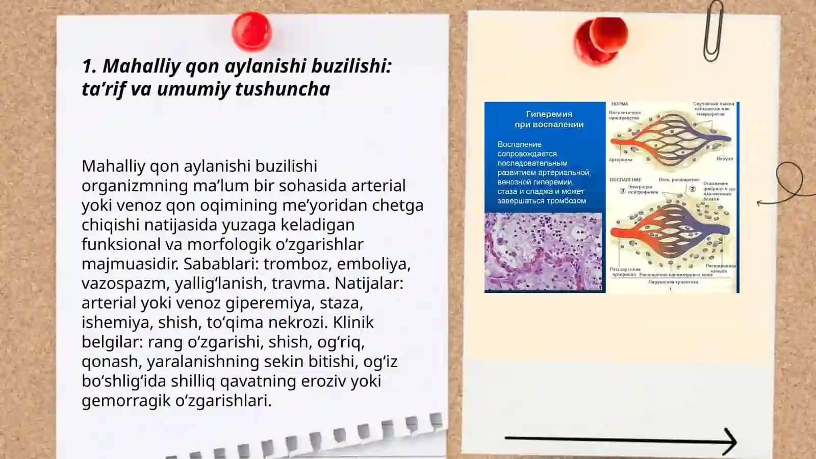 Mahalliy qon aylanishi buzilishi 3