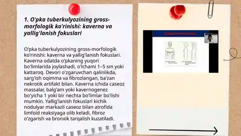 O'pkaning funksional marfalogiyasi zamonaviy sharoiyda o'pka tuberkulyozining marfalogik korinishi 3