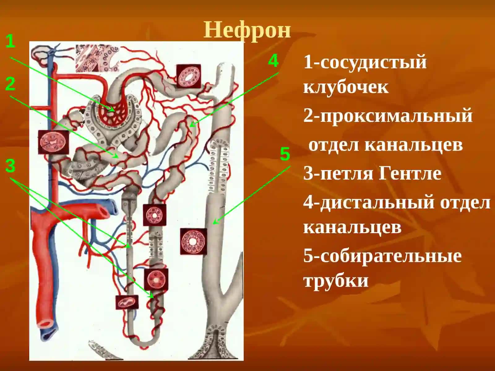ХРОНИЧЕСКИЙ ГЛОМЕРУЛОНЕФРИТ 3