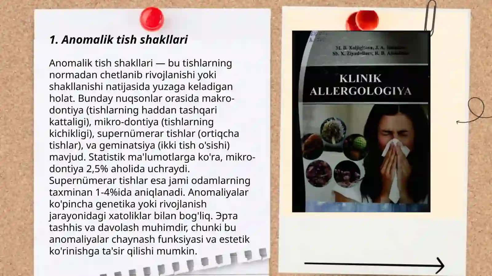 Anomalik tish shakllari 3