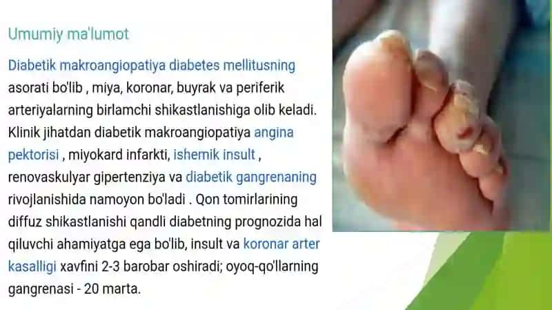 Diabetik  makroangiopatiyalar 3
