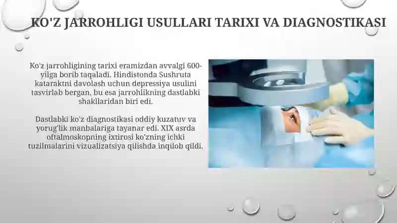 Ko'z jarrohligining asosiy usullari 3