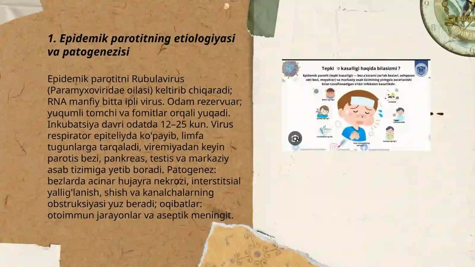 Epidemik parotit epidemiologiyasi, profilaktikasi va epidemiologik nazorati 3