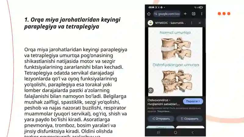 Umurtqa va tos suyaklari jarohatlaridan keyingi asoratlar 3