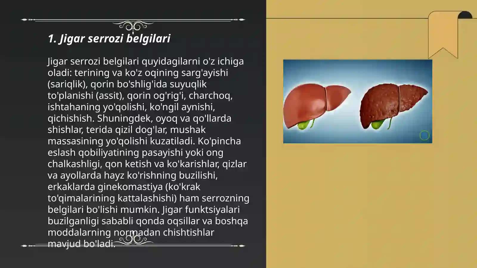 Jigar serrozi 3