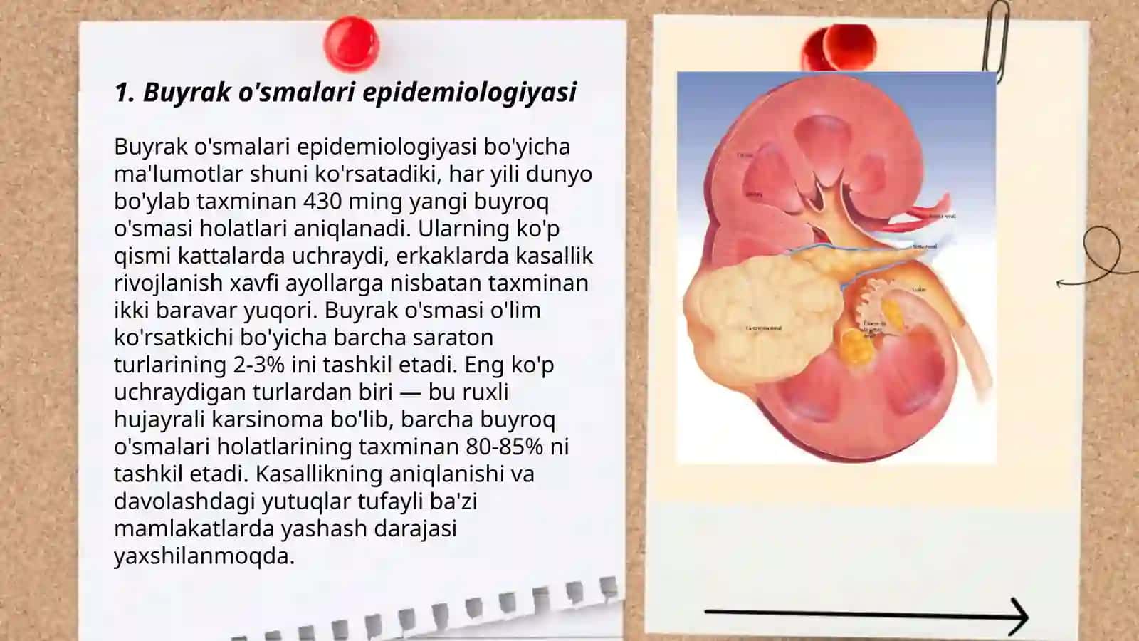 Buyrak o'smalari epidemiologiyasi 3